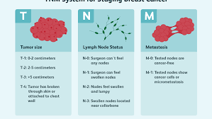 It happens in both males and females. Breast Tumor Size And Staging