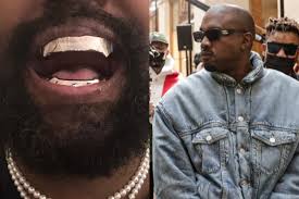 Kanye West spends almost 1 million dollars on titanium grill, did he remove  all his teeth? | Marca