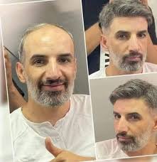 يلي بدو طريقة لتطويل ولإعادة انبات الشعر وتكثيفو وخاصة في مقدمة الرأس خفيف  وفراغات حطولي #تم ورح اعطيكون العلاج مسنجر