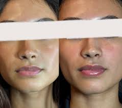 Lash and Company Med Spa -Dearborn