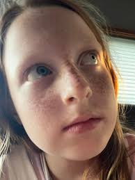 Prayers and Support for Lydia's Health