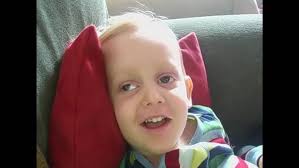 Jack Macpherson Krabbes Disease