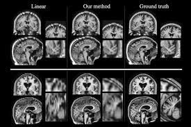 Study results are incomplete without information on what people were asked to do during the brain scan. New Technique Makes Brain Scans Better Mit News Massachusetts Institute Of Technology