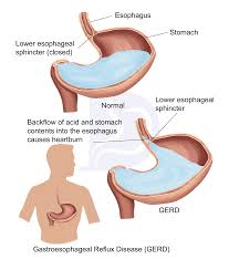 Image result for esophagus