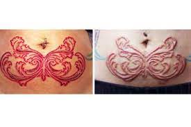 Pin On Scarification