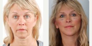 Kenneth K. Kim, MD, Board Certified Plastic Surgeon