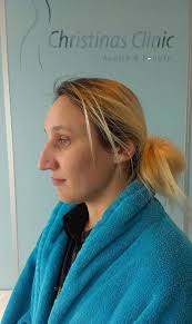 Mida teha, kui isegi oma mees peab sind koledaks?