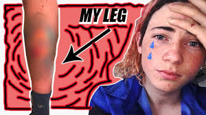 Amelia, don don and tony will first face a two hour cactus elimination tattoo. Download Worst Mystery Tattoo Ever Regret Self Loathing Scott Campbell Whole Glory In Hd Mp4 3gp Codedfilm