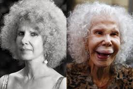 Is Plastic Surgery Is A Blessing Or A Sin Judge For Yourself As You Take A Bad Celebrity Plastic Surgery Plastic Surgery Gone Wrong Celebrity Plastic Surgery