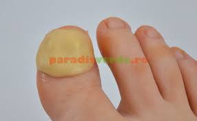 Era sa dea masina peste mine din fericire am scapat dar nu oricum. Leac De La Bunica Pentru PanariÅ£iu Paradis Verde