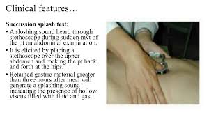 Image result for Succussion Splash