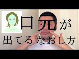 ボード 出っ歯 のピン