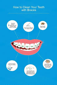 Pin On Health Is Wealth