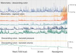 Low stomach acid is one of the major underlying causes in chronic inflammatory conditions. Chronic Constipation Mayo Clinic Proceedings