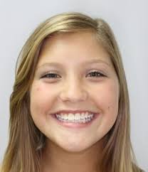 Orthodontist in Beaufort, SC