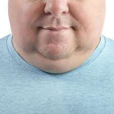 How To Get Rid Of Double Chin Causes And Treatments Family guy follows the hilariously offbeat griffin family. men s health