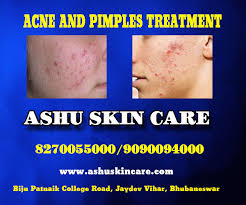 Iqra medical complex hospital, iqra hospital,near akbar chowk, moulana shoukat ali road, johar town, lahore. Best Dermatologist In Bhubaneswar Skin Hair Treatment Specialist In Bhubaneswar Cuttack Odisha Ashu Skin Care