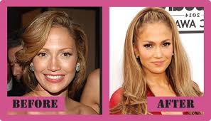 Anna is a communication expert and a life enthusiast. Jennifer Lopez Plastic Surgery Is Claimed To Be Only A Rumor