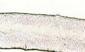 Photomicrograph Of Scale Pattern Of Antelope Hair Deer Family Hairs Download Scientific Diagram