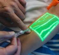 Shy veins can't hide from Vein Viewer Flex - Hamilton Health ...