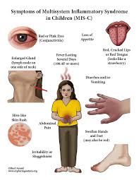 Some may appear in small patches on the body, and others may spread across a a rash is defined as a widespread eruption of skin lesions. Multisystem Inflammatory Syndrome In Children Mis C Symptoms Mini Poster