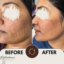 TOP 10 BEST Tattoo Removal in Windsor, ON, Canada