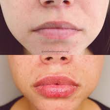 Stefani Neumann, MSN, FNP-C (@stefanineumann.np) • Instagram photos and  videos