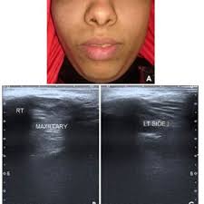 Moustafa ABDEL WAHAB