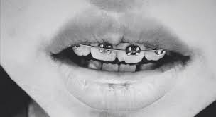 Black And White Braces For Teeth Brackets Teeth Mouth Lips Braces Black White Orthodontics Tooth Dientes Boca Ortodoncia Halloween Face Makeup Brace Face Face
