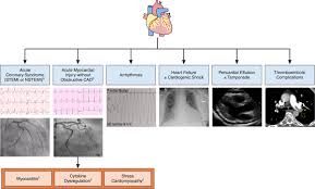 It is most often the result of an infection and/or inflammation caused by a virus. Description And Proposed Management Of The Acute Covid 19 Cardiovascular Syndrome Circulation