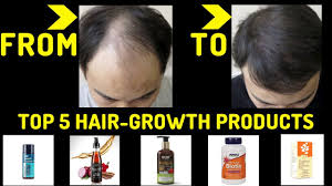 Top rated hair growth products of 2021. Top 5 Best Hair Growth Products In India 2019 Men And Women Youtube