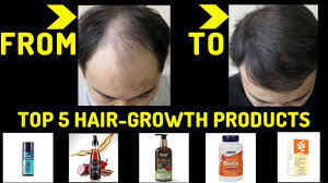 Top 5 Best Hair Growth Products In India 2019 Men And Women Youtube