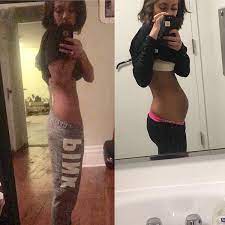 The endometriosis belly, the endometriosis tummy, the endo bloat, the endo belly, the endo that weird phenomena where your belly suddenly decides to make you look six months pregnant, not only. These Fearless Women Showwhat Endometriosis Really Looks Like Endofound