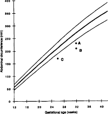 Fetal Ultrasound Biometry 2 Abdomen And Femur Length