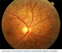 At eye surgeons of indiana, we treat you like family from the moment you walk through the door. What We Offer Vista Eye Centre