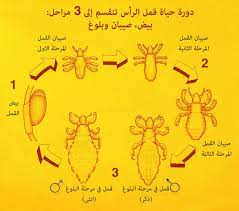 شكل القمل والصيبان بالصور حشرات تعيش بالراس رمزيات