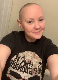 You got a head for bald. You're adorable.