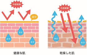 医師監修】乾燥肌はどう予防する？原因と防ぐ方法を徹底解説｜乾燥肌治療薬ヒルマイルド｜健栄製薬