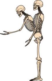 Forearm pain is any discomfort, soreness or pain in the part of the arm lying between the elbow and wrist. The Muscle Group Primarily Responsible For Pulling The Upper Body To A Vertical Position Is Called The Erector Spinae Muscles Description F Anatomy Muscl
