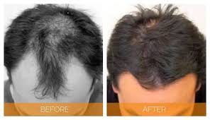 Your hair is going to look thicker, longer, and more intensive. Pin On Hair Skill