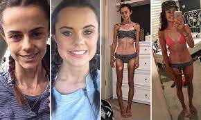 Maybe you would like to learn more about one of these? Blogger Documents Her Anorexia Recovery With Before And After Photos On Instagram Daily Mail Online