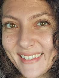 ✨️Beautiful baddies💖✨️ Im noticing more wrinkles around my eyes and  forehead. Im 32, mother of two small children. Im trying to guage if this  is normal for my age/stage of life or