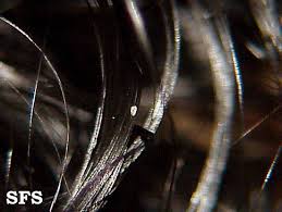 Present as branched hyphae & arthrospores both within and around hair shaft. White Piedra Wikidoc