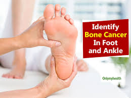 The pain may get worse with movement, and there may be swelling in nearby soft tissue. Major Signs That Indicate Bone Cancer In Foot And Ankle
