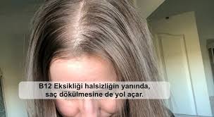 Gece Anne Destek Sac Dokulmesini Onlemek Icin Ne Yapmali Churchesnow Com