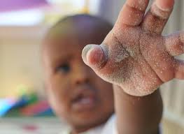 Childcare Ellenbrook