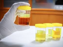 Maybe you would like to learn more about one of these? 7 Gejala Penyakit Kuning Bisa Jadi Tanda Masalah Pada Liver