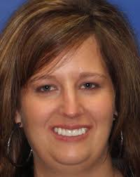 Dental Implant Services