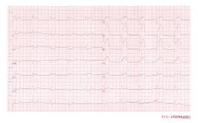 Rwanda Icd-10 Diagnostic Code Subset