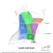 lymph node levels of the neck radiology reference article